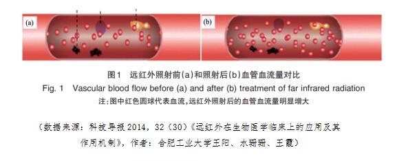 远红外血管.jpg
